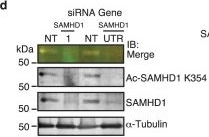 Fig.2.D showing Western Blotting in a Mus musculus (House mouse) sample from the publication: SAMHD1 deacetylation by SIRT1 promotes DNA end resection by facilitating DNA binding at double-strand breaks.