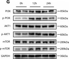 Fig.3.G showing Western Blotting in a Homo sapiens (Human) sample from the publication: A Hidden "Promoter": Schistosoma japonicum soluble egg antigen activates MAPK/PI3K-AKT pathways and inhibits autophagy to facilitate colorectal cancer.