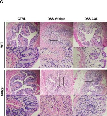 Fig.6.G showing Immunohistochemistry in a Mus musculus (House mouse) sample from the publication: Enhancement of efferocytosis through biased FPR2 signaling attenuates intestinal inflammation.