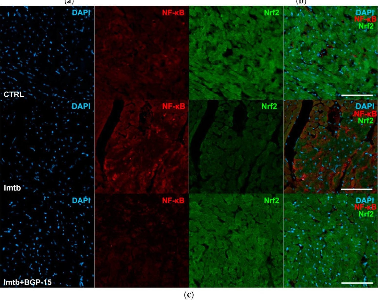 Fig.2.D showing Immunohistochemistry-immunofluorescence from the publication: Biochemical Insights into the Effects of a Small Molecule Drug Candidate on Imatinib-Induced Cardiac Inflammation.