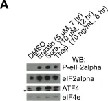 Fig.4.A showing Western Blotting from the publication: Pharmacological inhibition of cystine-glutamate exchange induces endoplasmic reticulum stress and ferroptosis.