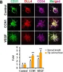 Fig.2.B showing Immunocytochemistry-immunofluorescence from the publication: CCN1 interlinks integrin and hippo pathway to autoregulate tip cell activity.