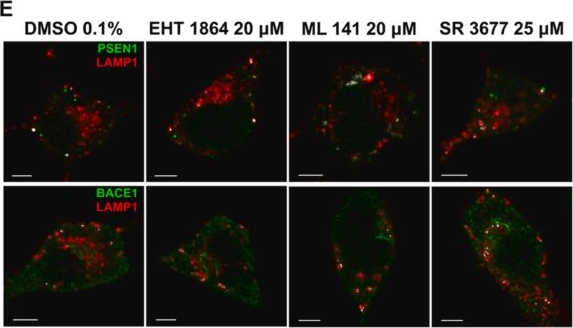 Fig.8.E showing Immunocytochemistry-immunofluorescence in a Mus musculus (House mouse) sample from the publication: Small GTPases control macropinocytosis of amyloid precursor protein and cleavage to amyloid-β.