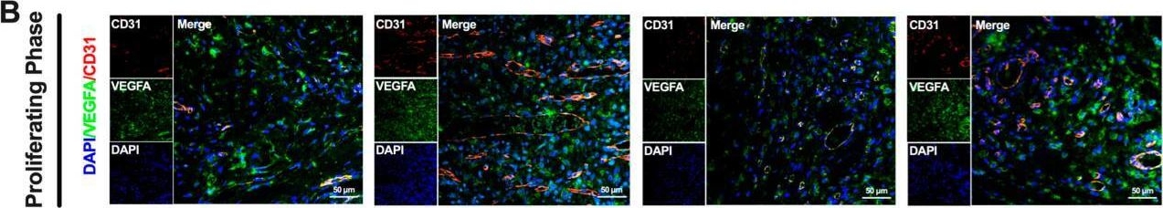 Fig.6.B showing Immunohistochemistry-immunofluorescence from the publication: Self-Healing Polymeric Puerarin Hydrogel Dressing Promotes Diabetic Wound Healing Through Synergistic Immunomodulation and Tissue-Regenerative Remodeling.