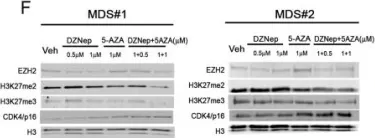 Fig.6.F showing Western Blotting in a Homo sapiens (Human) sample from the publication: The KDM2B- let-7b -EZH2 axis in myelodysplastic syndromes as a target for combined epigenetic therapy.