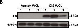 Fig.1.B showing Western Blotting in a Homo sapiens (Human) sample from the publication: Isolation methodology is essential to the evaluation of the extracellular vesicle component of the senescence-associated secretory phenotype.