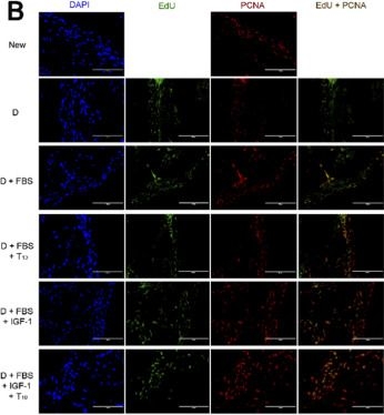 Fig.7.B showing Immunocytochemistry-immunofluorescence in a Cervidae (Deer) sample from the publication: The regulation of pedicle initiation by androgens in sika deer (Cervus nippon).