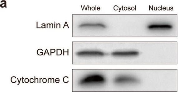 Fig.2.A showing Western Blotting from the publication: Lactate as a major epigenetic carbon source for histone acetylation via nuclear LDH metabolism.