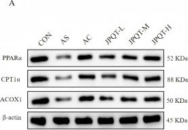 Fig.11.A showing Western Blotting in a Mus musculus (House mouse) sample from the publication: Jianpi Qutan Decoction improves hepatic lipid metabolism in atherosclerosis mice via PPARα-CPT1α pathway regulation.