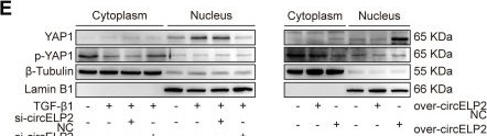 Fig.7.E showing Western Blotting from the publication: YAP1 converts circELP2-mediated biochemical signals to mechanical forces through promoting cytoskeleton remodeling in pulmonary fibrosis.
