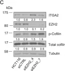 Fig.1.C showing Western Blotting in a Homo sapiens (Human) sample from the publication: EZH2 regulates cofilin activity and colon cancer cell migration by targeting ITGA2 gene.