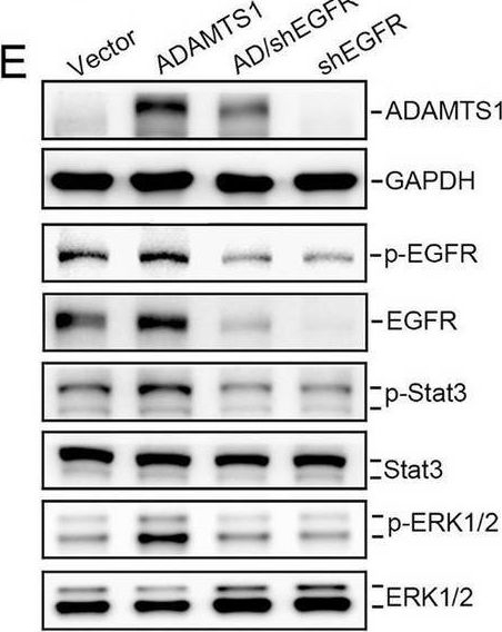 Fig.3.M showing Western Blotting in a Homo sapiens (Human) sample from the publication: The oncogenic ADAMTS1-VCAN-EGFR cyclic axis drives anoikis resistance and invasion in renal cell carcinoma.