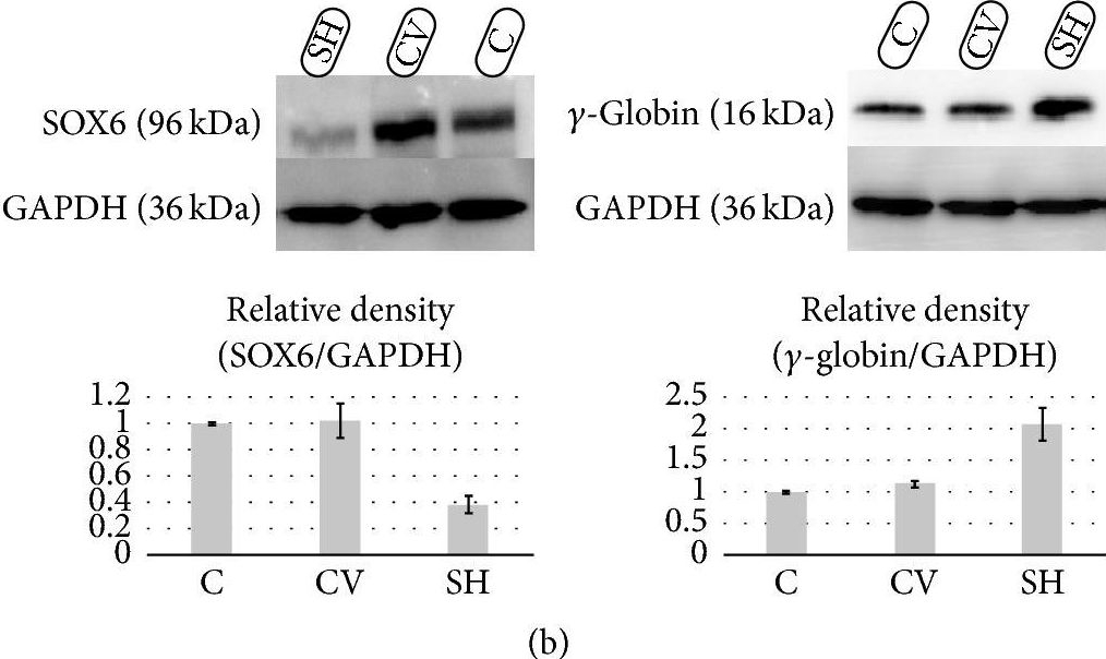 Fig.1.B showing Western Blotting in a Homo sapiens (Human) sample from the publication: SOX6 Downregulation Induces γ-Globin in Human β-Thalassemia Major Erythroid Cells.