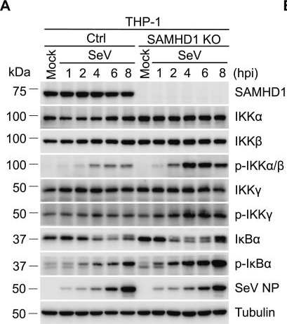 Fig.3.A showing Western Blotting in a Homo sapiens (Human) sample from the publication: The host antiviral protein SAMHD1 suppresses NF-κB activation by interacting with the IKK complex during inflammatory responses and viral infection.
