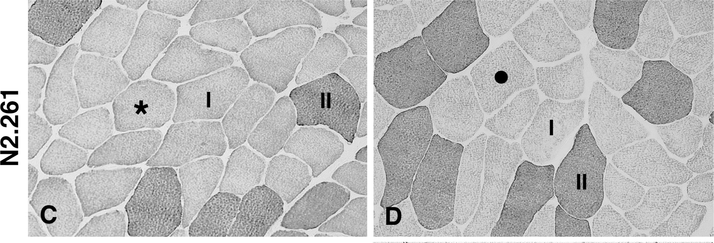 Fig.4.C,D showing Immunohistochemistry in a Homo sapiens (Human) sample from the publication: Re-evaluation of sarcolemma injury and muscle swelling in human skeletal muscles after eccentric exercise.