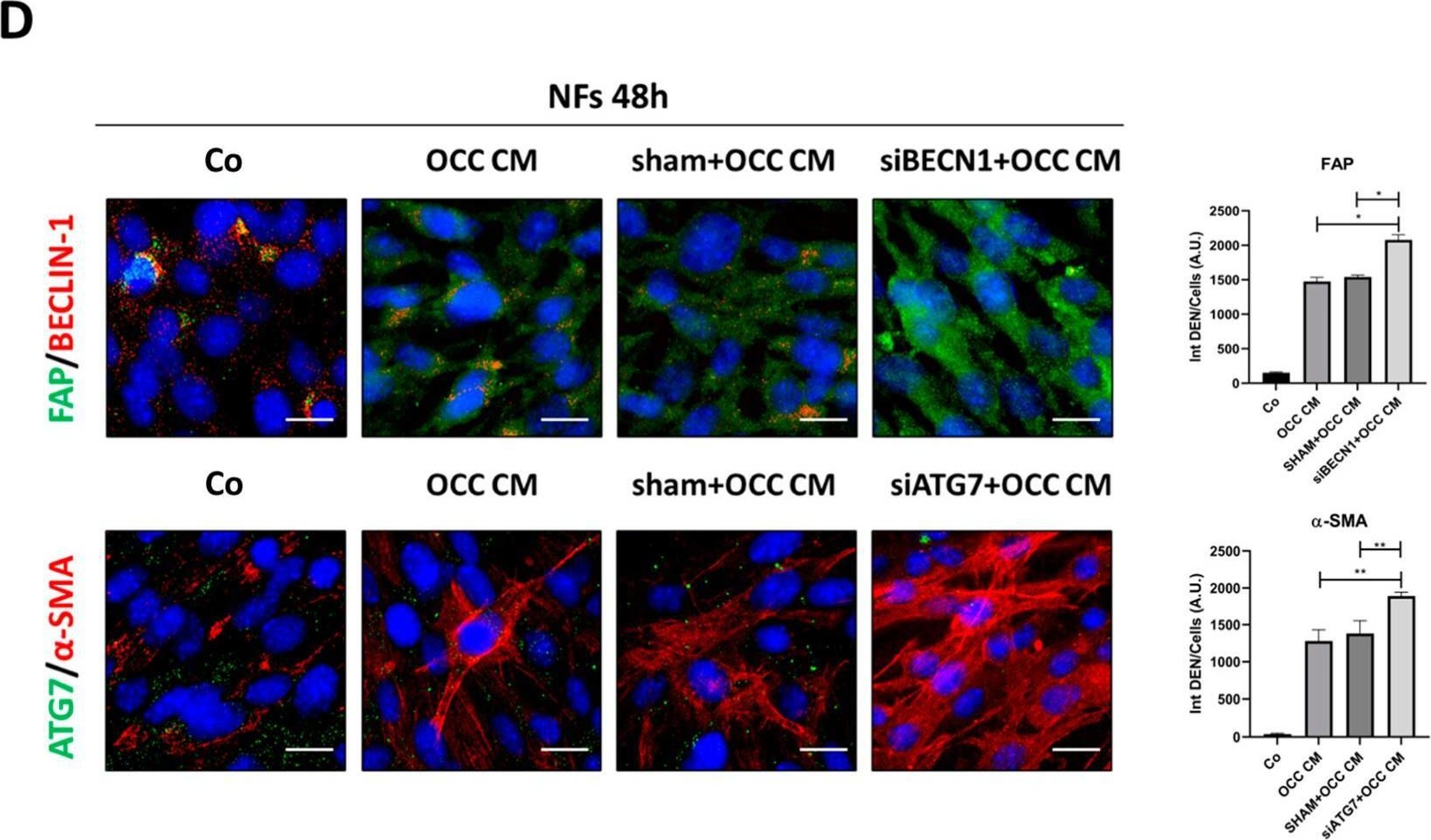 Fig.6.D showing Immunocytochemistry-immunofluorescence in a Homo sapiens (Human) sample from the publication: Ovarian Cancer Cell-Conditioning Medium Induces Cancer-Associated Fibroblast Phenoconversion through Glucose-Dependent Inhibition of Autophagy.