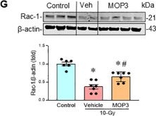 Fig.5.G showing Western Blotting in a Mus musculus (House mouse) sample from the publication: Radiation-induced eCIRP causes macrophage phagocytic dysfunction via mitochondrial impairment and ferroptosis.
