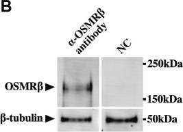 Fig.7.B showing Western Blotting from the publication: Essential roles of the cytokine oncostatin M in crosstalk between muscle fibers and immune cells in skeletal muscle after aerobic exercise.
