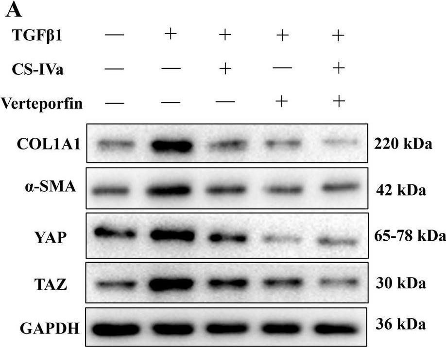 Fig.7.A showing Western Blotting in a Mus musculus (House mouse) sample from the publication: Chikusetsusaponin IVa targeted YAP as an inhibitor to attenuate liver fibrosis and hepatic stellate cell activation.