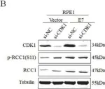 Fig.1.B showing Western Blotting from the publication: Phosphorylation of RCC1 on Serine 11 Facilitates G1/S Transition in HPV E7-Expressing Cells.
