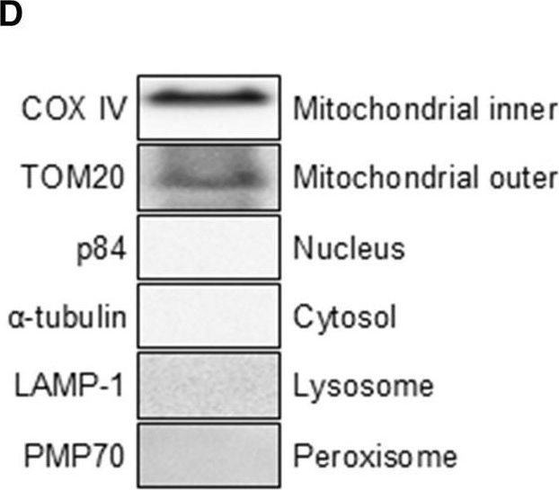 Fig.1.D showing Western Blotting from the publication: Plasma-derived mitochondrial transplantation attenuates paraspinal muscle atrophy following spinal surgery.