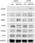 Fig.7.C showing Western Blotting in a Mus musculus (House mouse) sample from the publication: Neurons and glial cells acquire a senescent signature after repeated mild traumatic brain injury in a sex-dependent manner.