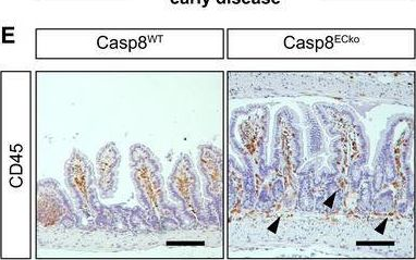 Fig.2.E showing Immunohistochemistry in a Mus musculus (House mouse) sample from the publication: Caspase-8 in endothelial cells maintains gut homeostasis and prevents small bowel inflammation in mice.