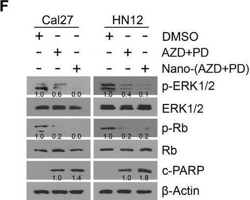 Fig.3.F showing Western Blotting from the publication: Dual CDK and MEK Inhibition potentiates CD8+ T cell-mediated antitumor immunity by inducing pyroptotic cell death in high-mutational head and neck cancer.