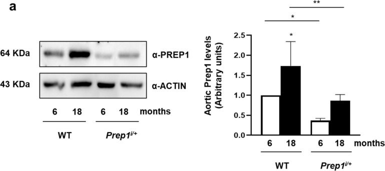Fig.6.A showing Western Blotting in a Mus musculus (House mouse) sample from the publication: Resveratrol Improves Endothelial Function by A PREP1-Mediated Pathway in Mouse Aortic Endothelial Cells.