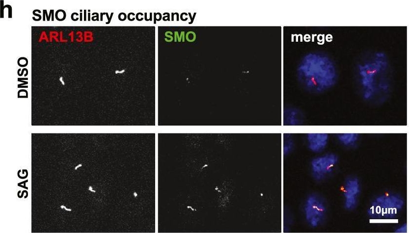 Fig.3.H showing Immunocytochemistry-immunofluorescence in a Mus musculus (House mouse) sample from the publication: Drug and siRNA screens identify ROCK2 as a therapeutic target for ciliopathies.