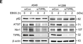 Fig.4.E showing Western Blotting in a Homo sapiens (Human) sample from the publication: TIPRL potentiates survival of lung cancer by inducing autophagy through the eIF2α-ATF4 pathway.