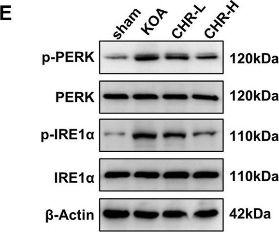 Fig.3.E showing Western Blotting in a Rattus norvegicus (Rat) sample from the publication: Chrysin ameliorates synovitis and fibrosis of osteoarthritic fibroblast-like synoviocytes in rats through PERK/TXNIP/NLRP3 signaling.