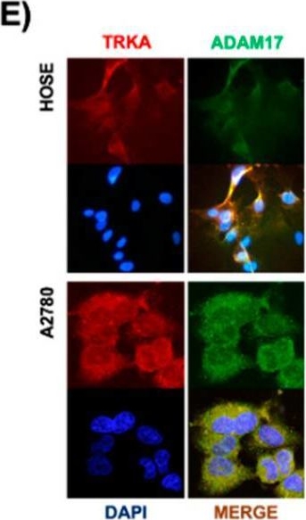 Fig.2.E showing Immunocytochemistry-immunofluorescence in a Homo sapiens (Human) sample from the publication: NGF/TRKA Promotes ADAM17-Dependent Cleavage of P75 in Ovarian Cells: Elucidating a Pro-Tumoral Mechanism.