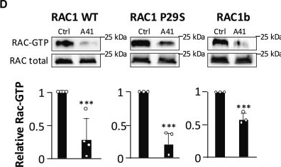 Fig.4.D showing Western Blotting in a Homo sapiens (Human) sample from the publication: A Rac-specific competitive inhibitor of guanine nucleotide binding reduces metastasis in triple-negative breast cancer.