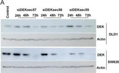 Fig.2.A showing Western Blotting from the publication: DEK is a potential marker for aggressive phenotype and irinotecan-based therapy response in metastatic colorectal cancer.