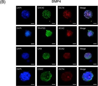 Fig.4.B showing Immunocytochemistry-immunofluorescence in a Homo sapiens (Human) sample from the publication: Epidermal growth factor induces a trophectoderm lineage transcriptome resembling that of human embryos during reconstruction of blastoids from extended pluripotent stem cells.