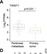 Fig.1.A showing Flow cytometry/Cell sorting in a Homo sapiens (Human) sample from the publication: TWIST1 mediated transcriptional activation of SPON2 drives colorectal cancer peritoneal metastasis through stromal cell signaling network.