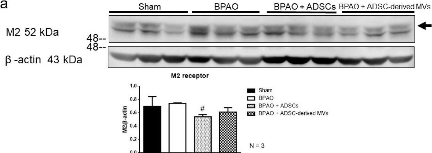 chrm2 antibodies - Antibody search engine - CiteAb