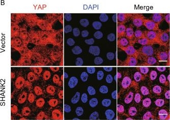 Fig.3.B showing Immunocytochemistry-immunofluorescence from the publication: SHANK2 is a frequently amplified oncogene with evolutionarily conserved roles in regulating Hippo signaling.