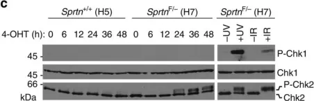 Fig.3.C showing Western Blotting from the publication: Spartan deficiency causes genomic instability and progeroid phenotypes.