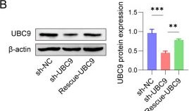 Fig.3.B showing Western Blotting from the publication: UBC9 mediates mitophagy to attenuate oxidative stress by regulating SUMOylation of PINK1 in the Parkinson's disease progression.