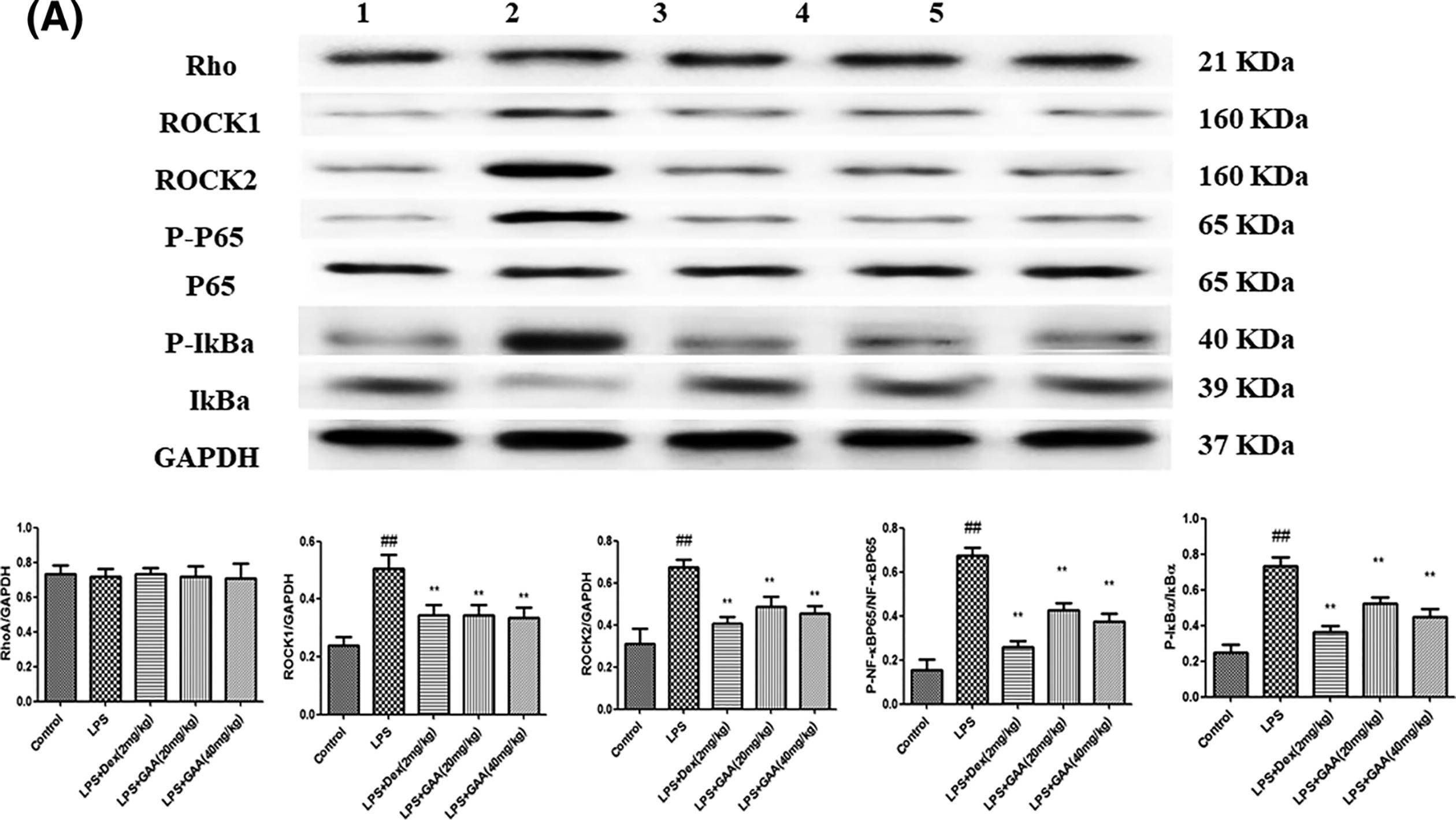 Fig.5.A showing Western Blotting from the publication: Ganoderic acid A attenuates lipopolysaccharide-induced lung injury in mice.