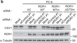 Fig.6.B showing Western Blotting in a Homo sapiens (Human) sample from the publication: ROR1 sustains caveolae and survival signalling as a scaffold of cavin-1 and caveolin-1.