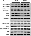Fig.5.C showing Western Blotting from the publication: Silencing of hypothalamic FGF11 prevents diet-induced obesity.