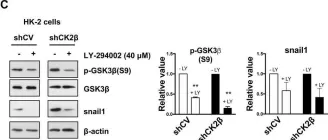 Fig.3.C showing Western Blotting from the publication: Effects of CK2β subunit down-regulation on Akt signalling in HK-2 renal cells.