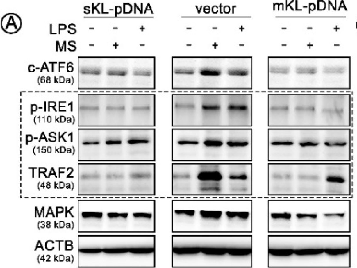 Fig.4.A showing Western Blotting in a Homo sapiens (Human) sample from the publication: Towards Age-Related Anti-Inflammatory Therapy: Klotho Suppresses Activation of ER and Golgi Stress Response in Senescent Monocytes.