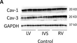Fig.2.A showing Western Blotting from the publication: Modulation of caveolins, integrins and plasma membrane repair proteins in anthracycline-induced heart failure in rabbits.