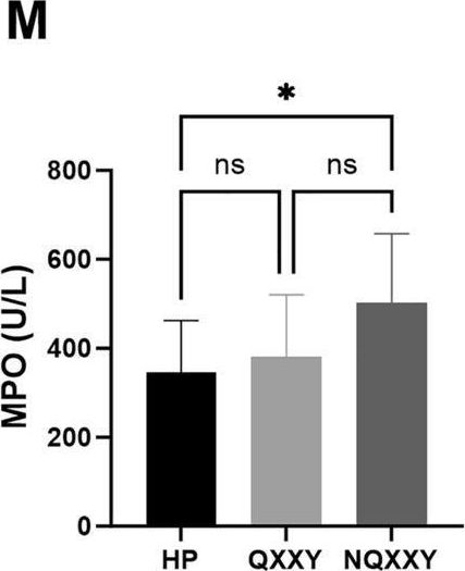 Fig.1.M from the publication: Integrating multi-omics and machine learning strategies to explore the "gene-protein-metabolite" network in ischemic heart failure with Qi deficiency and blood stasis syndrome.