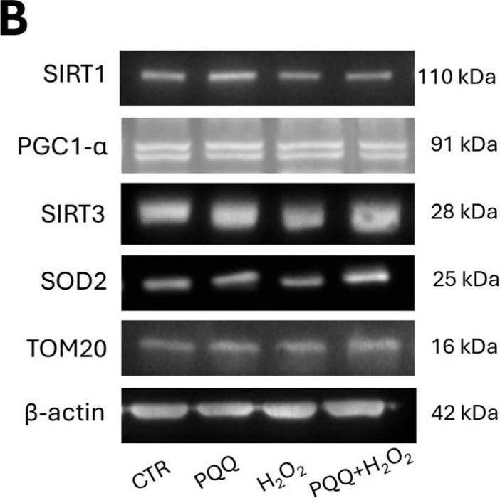 Fig.5.B showing Western Blotting from the publication: Pyrroloquinoline Quinone (PQQ) Attenuates Hydrogen Peroxide-Induced Injury Through the Enhancement of Mitochondrial Function in Human Trabecular Meshwork Cells.