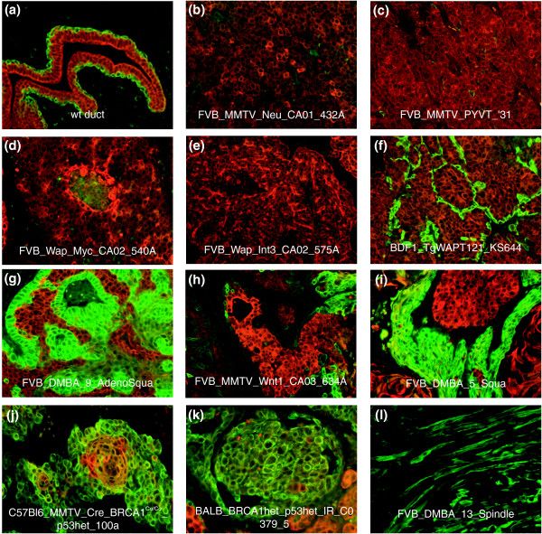 Identification of conserved gene expression features between murine mammary carcinoma models and human breast tumors.